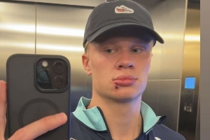 【小吧社交秀】哈兰德帅脸惨遭“破相”  内维斯女友青春甜美