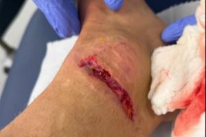 慎入！迪涅脚踝被踩而裁判无表示，换下后怒踢座椅找四官泰勒理论